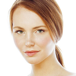 Rosacea