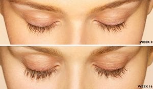 For Thicker and Longer Lashes, Latisse is Your Answer!