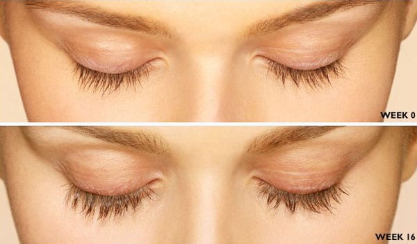 LATISSE Eyelash Enhancement Reading PA The Spa at Spring Ridge