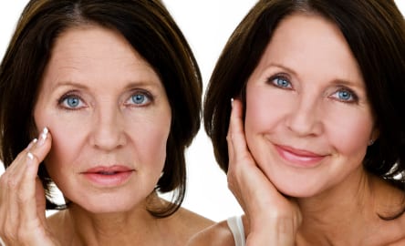 Best of North ridge facial plastic surgery Porn quicktime format reviews