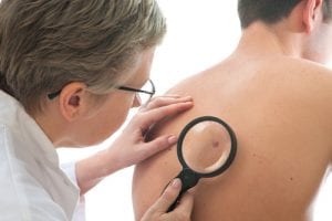 It’s Skin Cancer Awareness Month! Top Tips for Preventing Skin Cancer