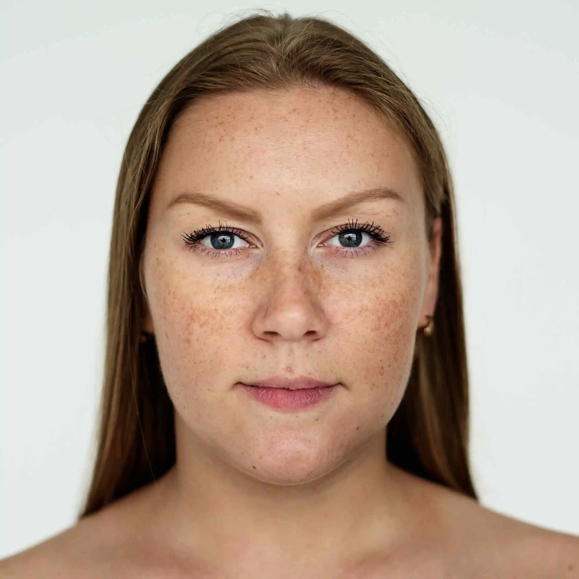 Enlarged Pores