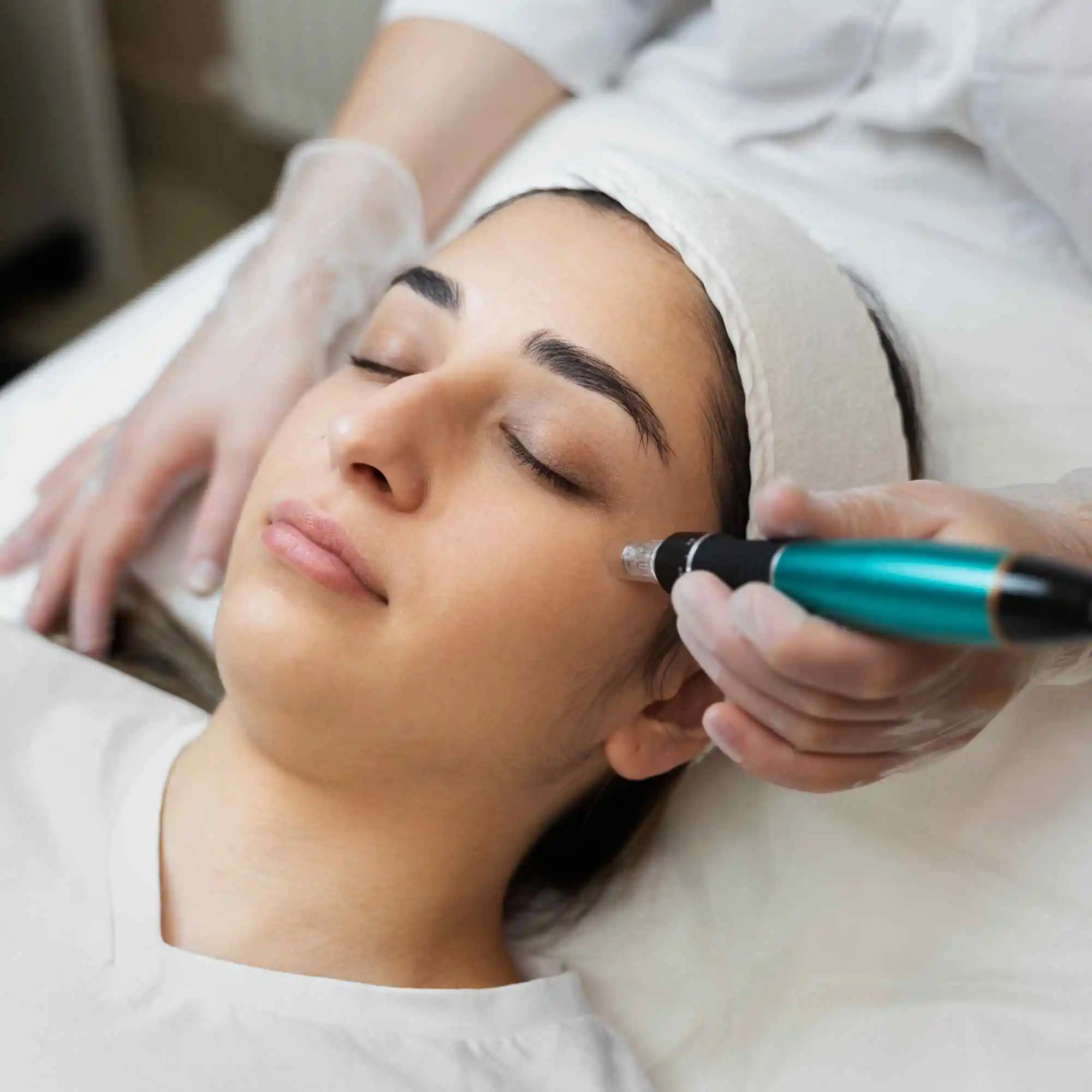 Microneedling Therapy Reading PA