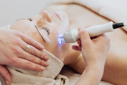 How Lasers Have Taken Over Skin Care