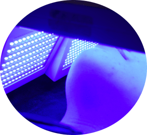 How Can Light Therapy Benefit Me? 6 Lightwave treatment close-up