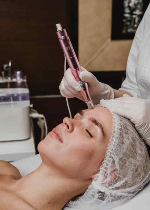 Microdermabrasion Session