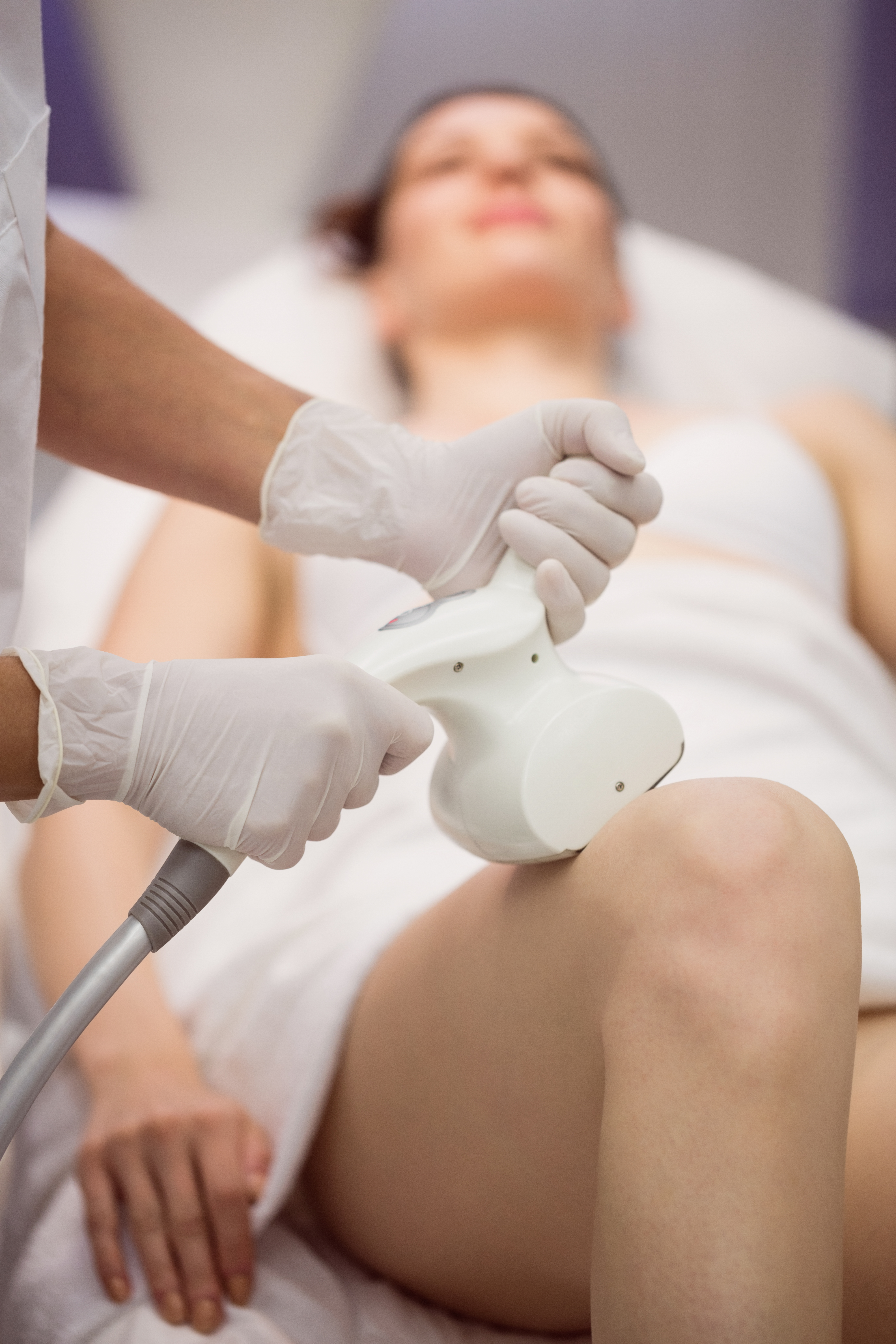 CoolSculpting treatment